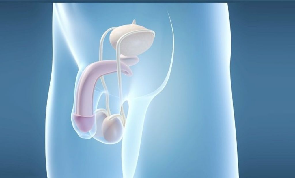 Prosthesis implantation is a surgical method of male penis enlargement